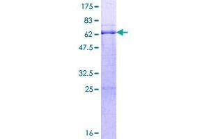 Image no. 1 for Ring Finger and FYVE-Like Domain Containing 1 (RFFL) (AA 1-327) protein (GST tag) (ABIN1317849)