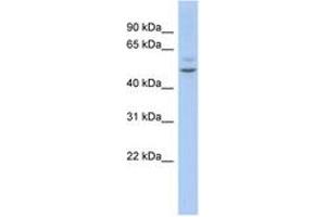 Image no. 1 for anti-Myocyte Enhancer Factor 2C (MEF2C) (AA 359-408) antibody (ABIN6744402) (MEF2C anticorps  (AA 359-408))