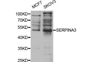 Western Blotting (WB) image for anti-serpin Peptidase Inhibitor, Clade A (Alpha-1 Antiproteinase, Antitrypsin), Member 3 (SERPINA3) antibody (ABIN1875398)