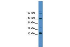 Image no. 1 for anti-Caspase 3 (CASP3) (AA 80-129) antibody (ABIN6745427) (Caspase 3 anticorps  (AA 80-129))