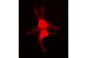 Immunofluorescent analysis of JNK3 staining in NIH3T3 cells. (MAPK10 anticorps  (C-Term))