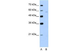 WB Suggested Anti-SLC22A7  Antibody Titration: 5. (SLC22A7 anticorps  (N-Term))