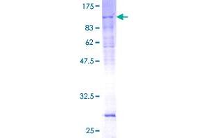 Image no. 1 for General Transcription Factor IIH, Polypeptide 1, 62kDa (GTF2H1) (AA 1-548) protein (GST tag) (ABIN1306140)