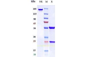 Anti-TFPI Reference Antibody (concizumab) on SDS-PAGE under reducing (R) condition. (Recombinant TFPI (Concizumab Biosimilar) anticorps)