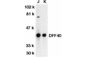 Image no. 1 for anti-DNA Fragmentation Factor, 40kDa, beta Polypeptide (Caspase-Activated DNase) (DFFB) (AA 3-18) antibody (ABIN203319)