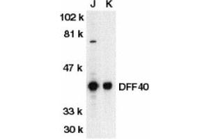 Image no. 1 for anti-DNA Fragmentation Factor, 40kDa, beta Polypeptide (Caspase-Activated DNase) (DFFB) (AA 3-18) antibody (ABIN203319) (DFFB anticorps  (AA 3-18))