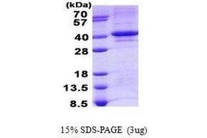 Figure annotation denotes ug of protein loaded and % gel used. (TDP1 Protéine)