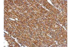 IHC-P Image Immunohistochemical analysis of paraffin-embedded U87 xenograft, using CYP27A1, antibody at 1:500 dilution.