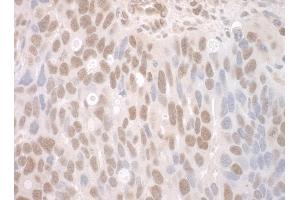 anti-Catenin, beta Like 1 (CTNNBL1) (AA 1-50) antibody