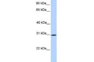 WB Suggested Anti-SIGLEC12 Antibody Titration:  0.