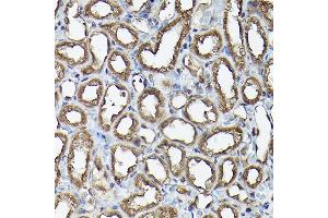 Immunohistochemistry of paraffin-embedded rat kidney using Ataxin-3  Rabbit pAb (ABIN3021828, ABIN3021829, ABIN3021830, ABIN1512615 and ABIN6216049) at dilution of 1:100 (40x lens).