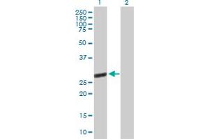 Western Blot analysis of TTC9B expression in transfected 293T cell line by TTC9B MaxPab polyclonal antibody. (TTC9B anticorps  (AA 1-239))