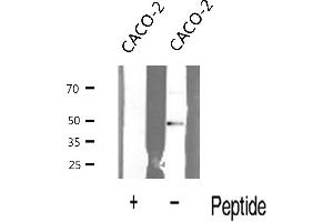 Western blot analysis of N Myc expression in CACO-2 cells (MYCN anticorps  (Internal Region))