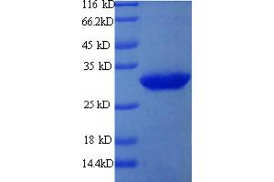 SDS-PAGE (SDS) image for ADP-Ribosyltransferase 1 (ART1) (AA 23-295) protein (His tag) (ABIN5713260)