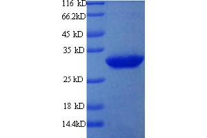 SDS-PAGE (SDS) image for ADP-Ribosyltransferase 1 (ART1) (AA 23-295) protein (His tag) (ABIN5713260) (ART1 Protein (AA 23-295) (His tag))