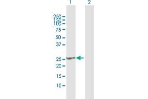 Western Blot analysis of SOHLH2 expression in transfected 293T cell line by SOHLH2 MaxPab polyclonal antibody. (SOHLH2 anticorps  (AA 1-225))