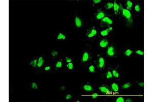 Image no. 3 for anti-Polymerase (RNA) I Polypeptide C, 30kDa (POLR1C) (AA 1-347) antibody (ABIN599083) (POLR1C anticorps  (AA 1-347))