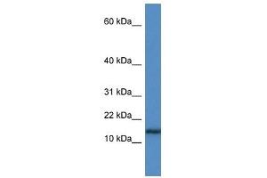 Western Blot showing HIST1H3A antibody used at a concentration of 1 ug/ml against Jurkat Cell Lysate (HIST1H3A anticorps  (N-Term))