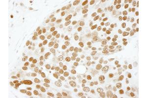 Immunohistochemistry (IHC) image for anti-Activated RNA Polymerase II Transcriptional Coactivator p15 (SUB1) (AA 77-127) antibody (ABIN7448719) (SUB1 anticorps  (AA 77-127))
