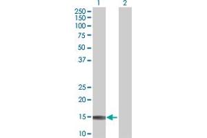 Lane 1: C1orf54 transfected lysate ( 14. (C1orf54 (1-131) 293T Cell Transient Overexpression Lysate(Denatured))