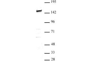 SMARCC1 / BAF155 antibody (pAb) tested by Western blot. (SMARCC1 anticorps  (N-Term))