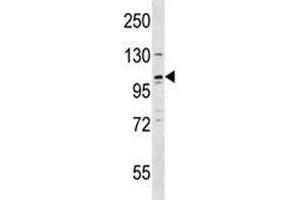 REST antibody western blot analysis in Jurkat lysate.