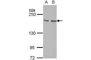 WB Image Sample (30 ug of whole cell lysate) A: Jurkat B: Raji 5% SDS PAGE antibody diluted at 1:1000 (KIF14 anticorps  (N-Term))