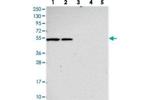 Western blot analysis of Lane 1: RT-4, Lane 2: U-251 MG, Lane 3: Human Plasma, Lane 4: Liver, Lane 5: Tonsil with SLC24A6 polyclonal antibody . (SLC24A6 anticorps)