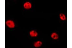 ABIN6277205 staining HepG2 by IF/ICC. (Histone 3 anticorps  (H3K79me2))