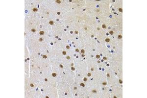 Immunohistochemistry of paraffin-embedded rat brain using PPP1R8 Antibody (ABIN5974046) at dilution of 1/100 (40x lens). (PPP1R8 anticorps)