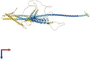 Ankyrin Repeat Domain 35 (ANKRD35) (AA 1-1001) protein (His tag)