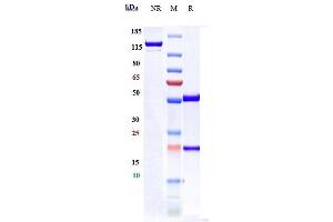 Anti-ENPP3 / CD203c Reference Antibody (Ags-16C3F) on SDS-PAGE under reducing (R) condition.