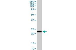 RPS5 monoclonal antibody (M01), clone 3G3.