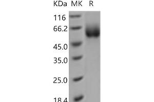 Western Blotting (WB) image for Solute Carrier Family 3 (Activators of Dibasic and Neutral Amino Acid Transport), Member 2 (SLC3A2) protein (His tag) (ABIN7321118)