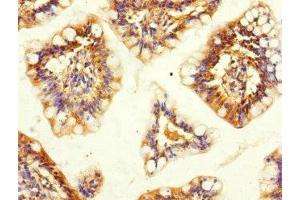Immunohistochemistry of paraffin-embedded human small intestine tissue using ABIN7170368 at dilution of 1:100 (SNX18 anticorps  (AA 449-628))