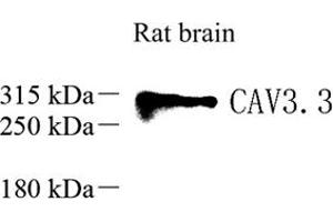 Western blot analysis of Ca(v)3. (CACNA1I anticorps)