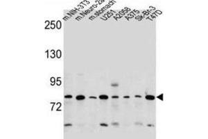 Western Blotting (WB) image for anti-Discoidin, CUB and LCCL Domain Containing 2 (DCBLD2) antibody (ABIN2997563) (DCBLD2 anticorps)