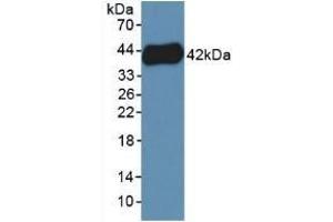 Detection of Recombinant PF4V1, Human using Polyclonal Antibody to Platelet Factor 4 Variant 1 (PF4V1) (PF4V1 anticorps  (AA 1-104))