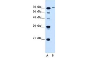 Image no. 1 for anti-Solute Carrier Organic Anion Transporter Family, Member 6A1 (SLCO6A1) (AA 101-150) antibody (ABIN205026) (SLCO6A1 anticorps  (AA 101-150))