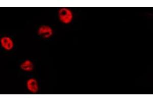 ABIN6278580 staining HepG2 by IF/ICC. (HIST1H2BH anticorps  (N-Term))