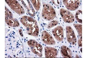 Immunohistochemical staining of paraffin-embedded Human Kidney tissue using anti-SULT1C2 mouse monoclonal antibody. (SULT1C2 anticorps)