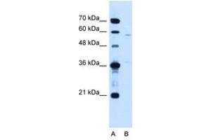 Image no. 1 for anti-Coiled-Coil Domain Containing 112 (CCDC112) (AA 71-120) antibody (ABIN205068) (CCDC112 anticorps  (AA 71-120))