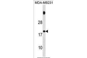 SPNXB Antibody (Center) (ABIN1881824 and ABIN2839075) western blot analysis in MDA-M cell line lysates (35 μg/lane). (SPANXB1 anticorps  (AA 17-47))