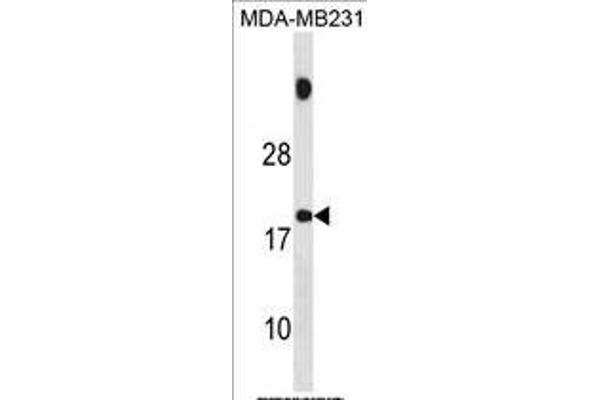 SPANXB1 Antikörper  (AA 17-47)