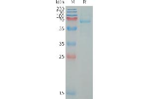 Human LI Protein, His Tag on SDS-PAGE under reducing condition.