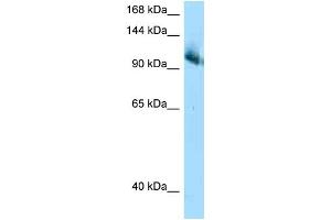 WB Suggested Anti-Cul4b AntibodyTitration: 1. (Cullin 4B anticorps  (C-Term))