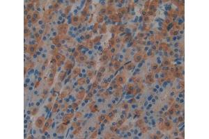 Used in DAB staining on fromalin fixed paraffin- embedded stomach tissue