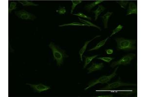 Immunofluorescence of monoclonal antibody to SYT1 on HeLa cell.
