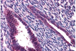 Human Uterus: Formalin-Fixed, Paraffin-Embedded (FFPE) (JMJD1C anticorps  (N-Term))