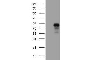 Western Blotting (WB) image for anti-Plasminogen Activator Inhibitor 1 (SERPINE1) antibody (ABIN1499717) (PAI1 anticorps)